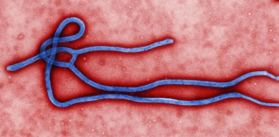 Ministério do Turismo emite comunicado com orientações sobre o Ebola